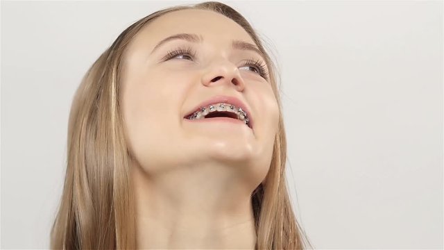 Woman laughs and shows her smile with braces. White. Slow motion