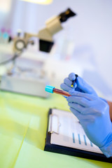 Woman working in a laboratory. He writes with a felt pen. Select focus