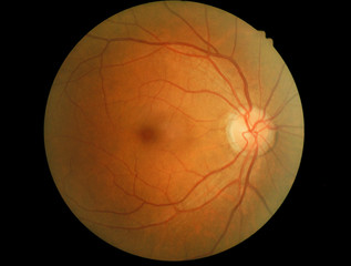 Human eye anatomy, retina, optic disc artery and vein etc. takin