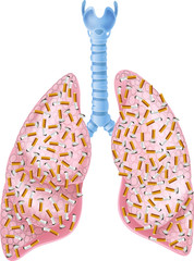 Illustration of Smokers Lungs