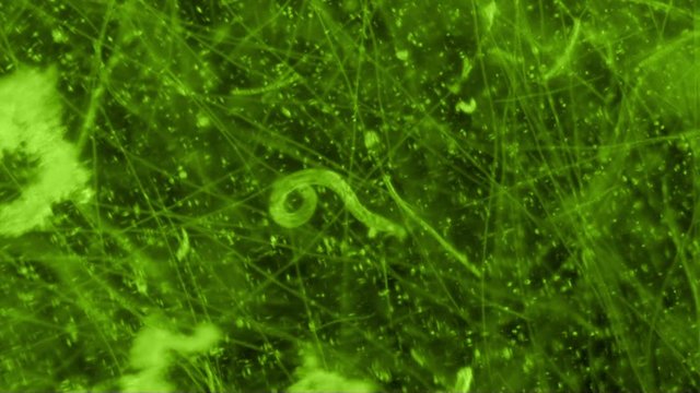 Nematode Worm Coiling In Microscope View at 100x