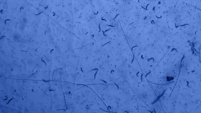 Nematode Worms Seen on Microscope at 40x with Blue Filter