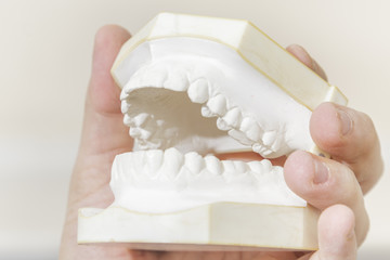 Fototapeta na wymiar Man holding dental casting