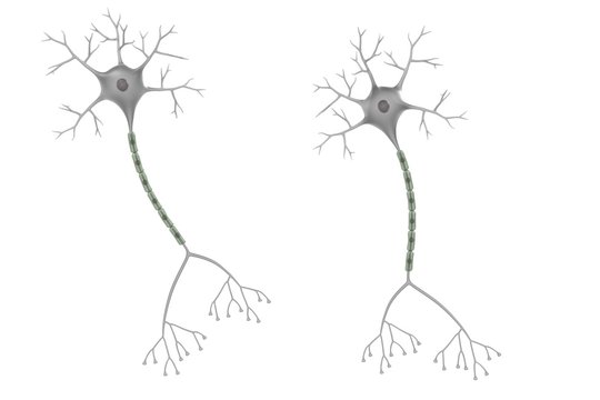 3d render of brain neuron