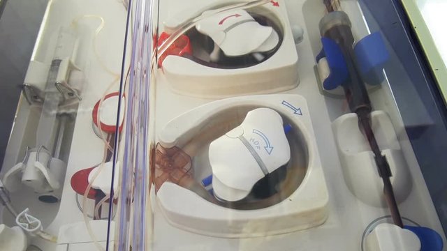 Medical Device Performing Dialysis Procedure
