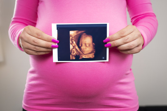 Pregnant woman holds ultrasound photo at the belly