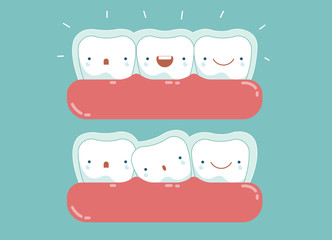 Invisible braces ,dental and tooth concept
