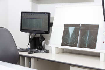 Hospital desk x-ray evaluation