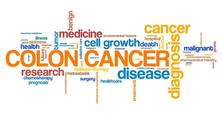 Colon cancer