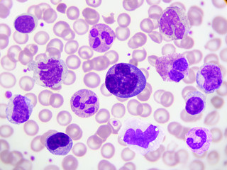 Kind of white blood cell (WBC) in blood smear