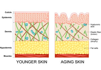 younger skin and older skin