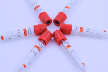 Medical test tube with blood sample on white background