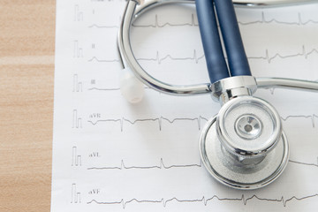 Stethoscope on electrocardiogram chart