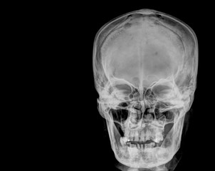 skull x-rays image sagital plane