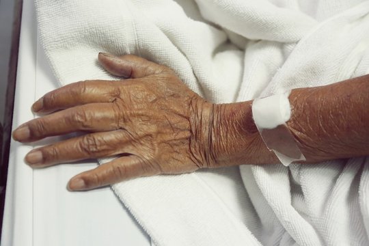 old woman's hand is on a drip receiving a saline solution.