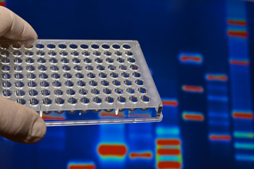 DNA testing in genetic laboratories.