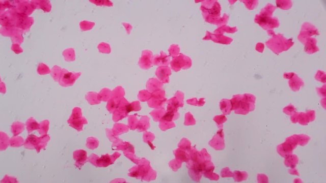 Multiple squamous epithelium under the microscope - Abstract pink dots on white background.