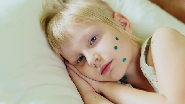 Sick girl with chickenpox trying to sleep on a pillow