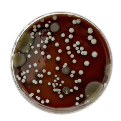 Petri dish with bacteria colonies