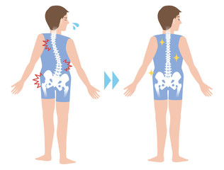 Obraz premium chiropractic before after image, from bad posture to good posture, man's body and backbone, vector illustration