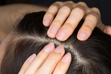 Fototapeta premium 頭皮のクローズアップ / 若い女性