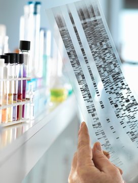 Scientist Viewing A DNA Sequence Gel To Understand The Genetic Information Of A Human In A Laboratory