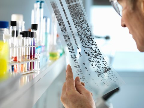 Scientist viewing a DNA sequence gel to understand the genetic information of a human in a laboratory