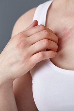 Cropped close up shot of young woman scratching her chest with fingers