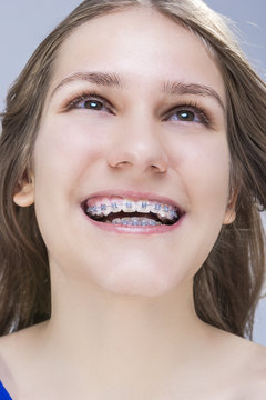 Closeup Portrait of Caucasian Female Teenage Girl With Teeth Braces