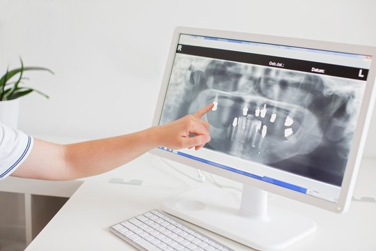 Person pointing at x-ray image on computer screen