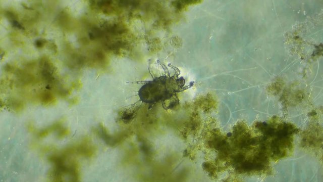 Acari Mite In Aquatic Plant Environment. Microscope 100x