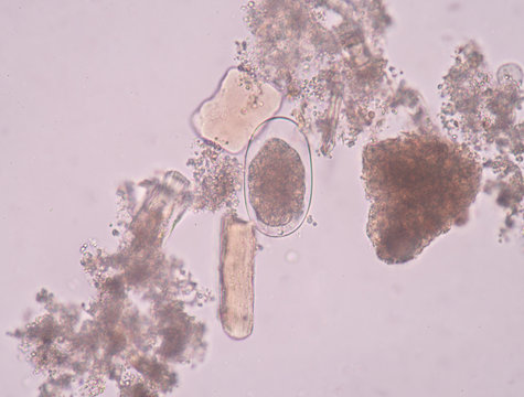 Schistosoma Bilder Durchsuchen 284 Archivfotos, und