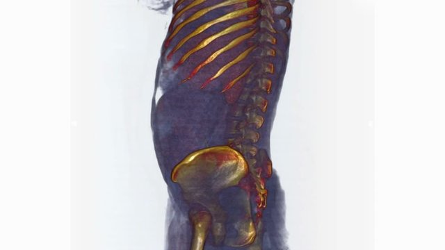 Fetus in uterus
