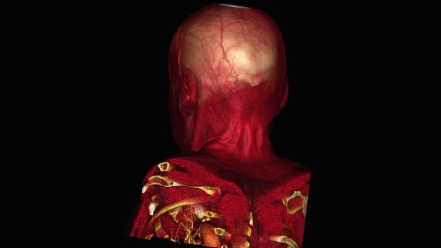 Human skull