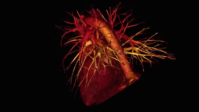 Coronary arteries