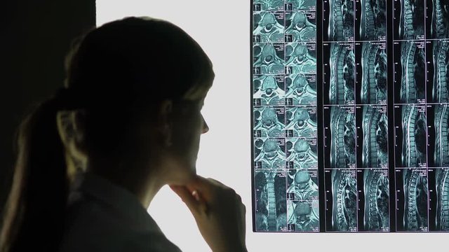 Rare case of spinal injury, doctor looking at patient's x-ray, making diagnosis