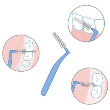 歯間ブラシ の画像 2 737 件の Stock 写真 ベクターおよびビデオ Adobe Stock