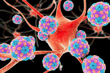 Human Parechoviruses affecting neuron, 3D illustration. Parechoviruses cause respiratory, gastrointestinal infections and are associated with brain damage and developmental disorders in neonates