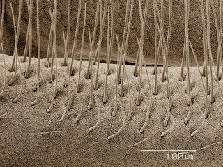 Coloured SEM of antenna of sand fly (Ceratopogonidae)
