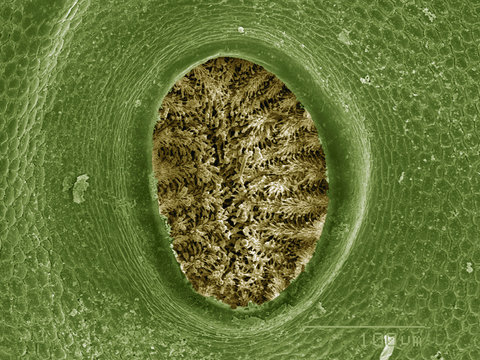 Coloured SEM of spiracle of caterpillar (Psychidae)