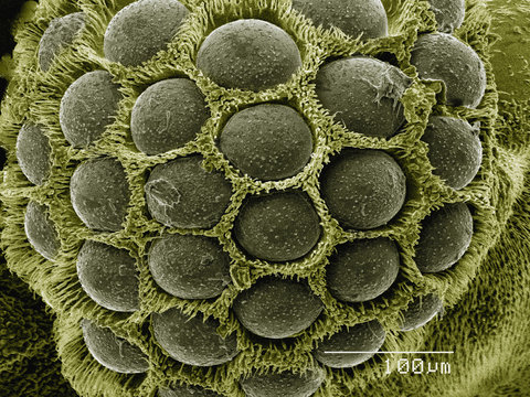 Coloured SEM of eye of twisted wing parasite (Strepsiptera)