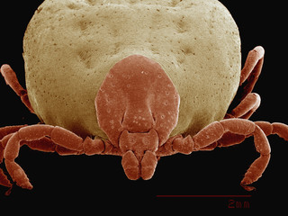 Coloured SEM of engorged female dog tick