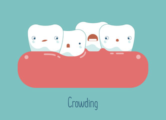 Crowding teeth ,dental concept