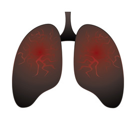 Smoker's lung , No Smoking Concept Vector Illustration