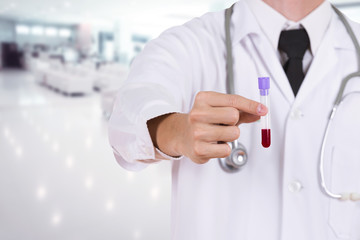 close up a medical test glass with blood