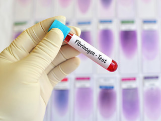 Fibrinogen test