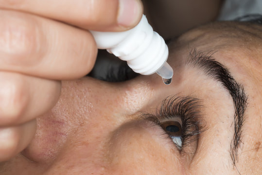 Person Pouring Drops In Eyes With Eyedropper.