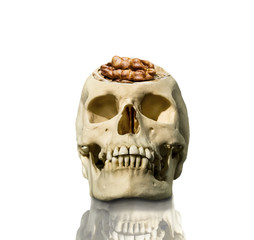 The exposed skull with the brain in the form of a walnut