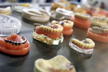 Samples dentures