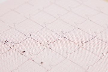 Medical report and cardiogram